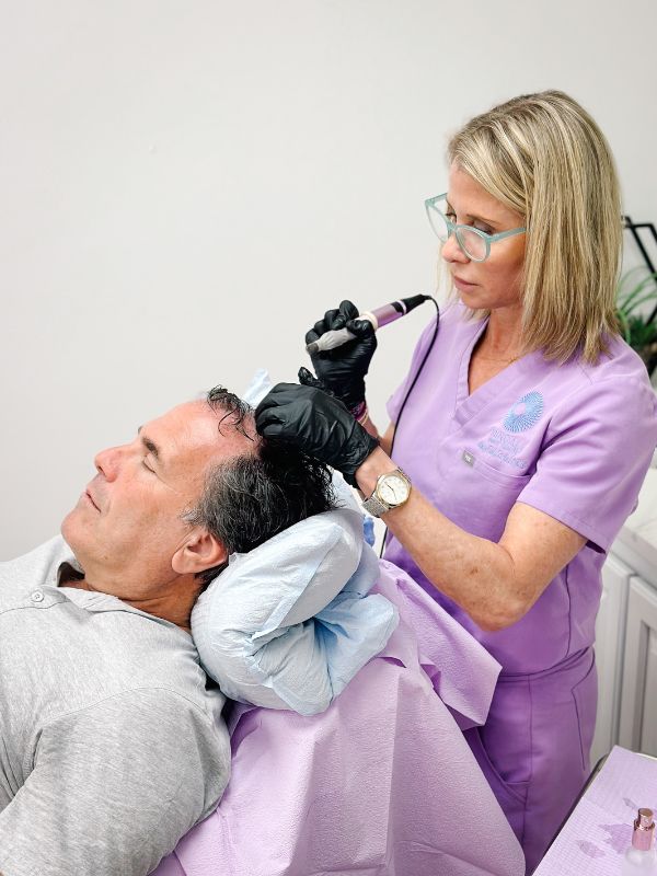 Wendy Finkelstein, PA-C microneedling a man's had to help stimulate hair growth.